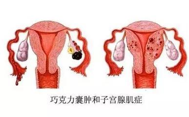 通草的功效與作用，探索其在輸卵管堵塞治療中的應用